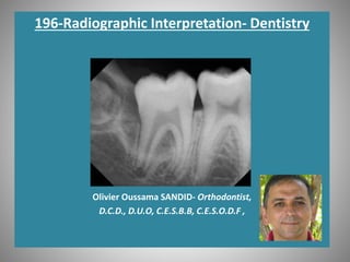 196-Radiographic Interpretation- Dentistry
Olivier Oussama SANDID- Orthodontist,
D.C.D., D.U.O, C.E.S.B.B, C.E.S.O.D.F ,
 