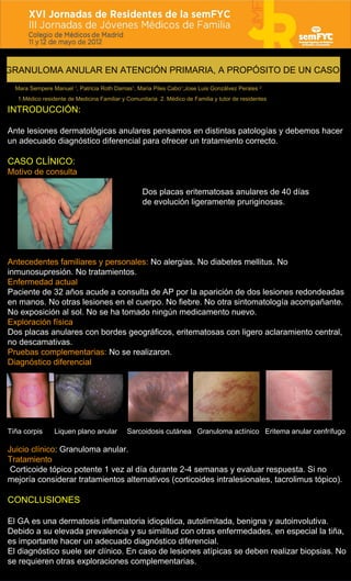 GRANULOMA ANULAR EN ATENCIÓN PRIMARIA, A PROPÓSITO DE UN CASO
  Mara Sempere Manuel 1, Patricia Roth Damas1, Maria Piles C...