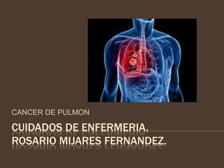 CANCER DE PULMON
CUIDADOS DE ENFERMERIA.
ROSARIO MIJARES FERNANDEZ.
 