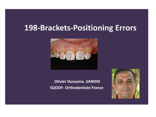 198-Brackets-Positioning Errors
Olivier Oussama .SANDID
SQODF- Orthodontiste France
 