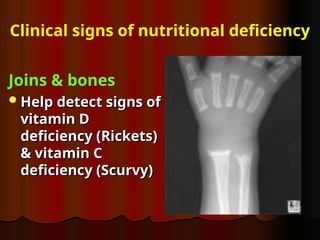 Comprehensive Assessment of Nutritional Status: Methods and Clinical ...