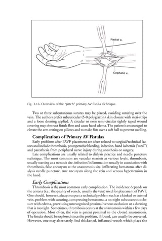 Alternatively Dressing Access for Dialysis Surgical and Radiologic Procedures 2nd Ed Vademecum ...