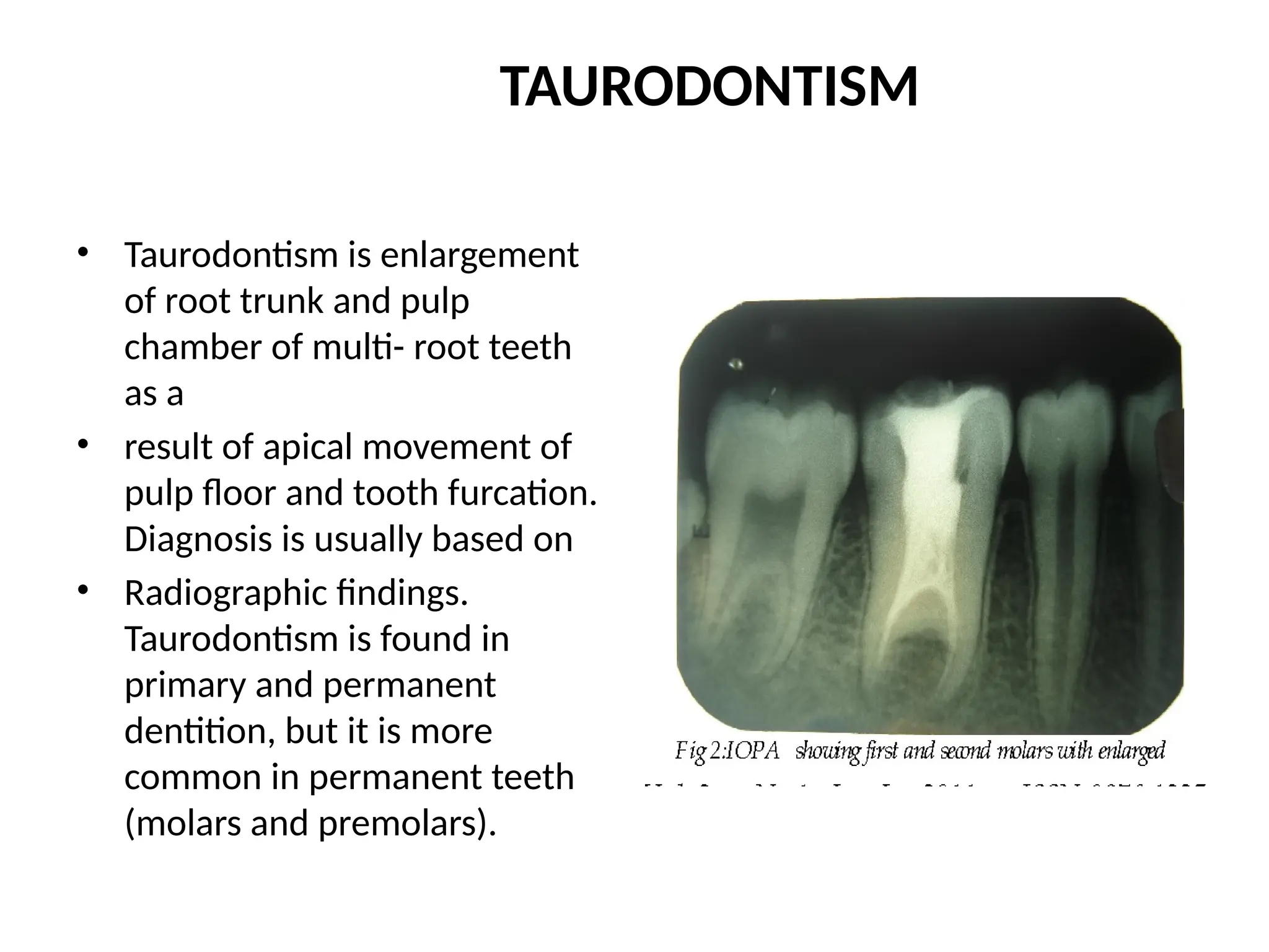 Bull Tooth 199.CONGENITAL ANOMALIES OF TEETH an INTRO.pptx