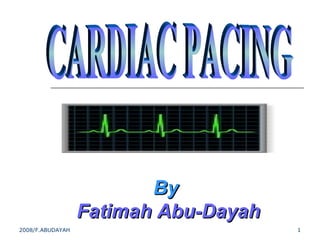 2008/F.ABUDAYAH 1
ByBy
Fatimah Abu-DayahFatimah Abu-Dayah
 