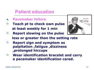 Pacemaker Reporting Pacemaker Operation | PPT