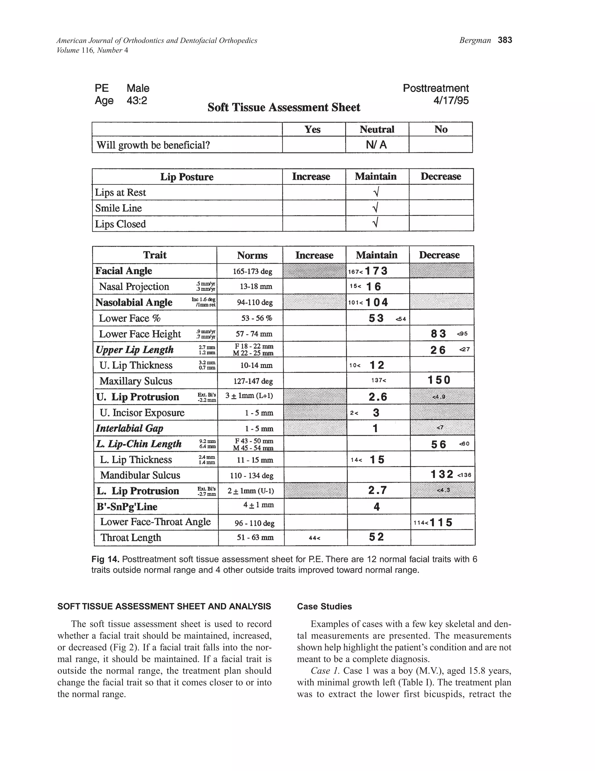 American Journal of Orthodontics and Dentofacial Orthopedics Bergman 383
Volume 116, Number 4
SOFT TISSUE ASSESSMENT SHEET AND ANALYSIS
The soft tissue assessment sheet is used to record
whether a facial trait should be maintained, increased,
or decreased (Fig 2). If a facial trait falls into the nor-
mal range, it should be maintained. If a facial trait is
outside the normal range, the treatment plan should
change the facial trait so that it comes closer to or into
the normal range.
Case Studies
Examples of cases with a few key skeletal and den-
tal measurements are presented. The measurements
shown help highlight the patient’s condition and are not
meant to be a complete diagnosis.
Case 1. Case 1 was a boy (M.V.), aged 15.8 years,
with minimal growth left (Table I). The treatment plan
was to extract the lower first bicuspids, retract the
Fig 14. Posttreatment soft tissue assessment sheet for P.E. There are 12 normal facial traits with 6
traits outside normal range and 4 other outside traits improved toward normal range.
 