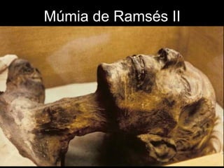 Múmia de Ramsés II
 