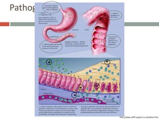 Cdiff Pathogen C.difficile | PPTX
