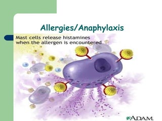 Allergies/Anaphylaxis  