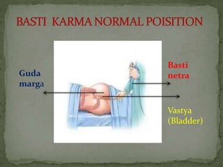 Basti
netraGuda
marga
Vastya
(Bladder)
 