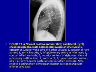 19 cardiac anatomy and Imaging techniques Dr. Muhammad Bin Zulfiqar | PPTX