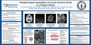 Nasopharyngeal Aspergillosis and Acute Ischemic Stroke
in a Diabetic Patient
N. Grauman Neander, MASc, OMSIII; C. Marske, DO; A. Forrester, MD; J. Grauman, MA, MSIII
Western University of Health Sciences COMP-NW, Lebanon, OR
Diagnosis & Treatment of Aspergillosis
•Specific lung CT findings5 GM (No findings in this patient)
• Halo sign
• Air Crescent sign
•Culture 33% sensitive6 (Negative in this patient)
•Biopsy with acute angle branching on histopathology5 (Initially
negative in this patient)
•GM assay 87% sensitive6 (Not performed)
•Treatment: Voriconazole (200mg Q12H minimum 6-12 weeks)7
•Patient survived and continues on Voriconazole
References
History of Present Illness
Unique Aspects of Case
1. Patient’s unique risk factors of chronic ear infection,
marijuana use and diabetes demonstrate importance of
clinical suspicion in spite of negative diagnostic testing
and considerations when advising a patient on marijuana
use
2. Patient had irreversible ischemic stroke even after
completion of 3 months of voriconazole treatment
.
Invasive Aspergillosis
◦ To recognize and diagnose aspergillosis
as a rare and serious cause of vascular compromise in the
immunocompetent
◦ To recognize Galactomaman (GM) assay as an important
screening test for suspected aspergillosis
◦ To understand the importance of empiric treatment with
voriconazole (a riazole antifungal medication)
Learning Objectives Imaging Reveals Nasocranial Invasion
• 69 year old male
• Presents to emergency department after wife found him
lying on floor unable to move his right arm and leg
Past Medical History
• Hypertension, hyperlipidemia, Diabetes mellitus T2
• Bladder carcinoma (2010), BPH
• Chronic resistant otitis media , hearing loss (2010-2014)
• Dramatic weight loss (2013)
• Dementia, depression, insomnia (2014)
• Hyperplasia on biopsy placed on hospice (2014)
• Invasive aspergillosis (09/2014 )
• Acute Ischemic Stroke (01/2015)
Social History
• Former cigarette smoker and marijuana user
• Former construction worker from Southern California
large area of restricted
diffusion in the upper pons
just to the left of midline and
just below the level of the
interpeduncular cistern.
Complex stellate rim-
enhancing collection
(MRI) - 09/2014
Worrisome for abscess
Bilateral mastoid effusions
(MRI) -09/2014
Consistent with chronic
omits media
Absent right vertebral flow
void (MRI) -09/2014
First evidence of vascular
involvement
Effacement of fossa of
Rosenmüller
(CT) -07/2014
Suspicion of Brain Mass
Stroke Evaluation
(01/2015)
•Angioinvasive fungus
with affinity for small
vessels2 &
atherosclerosis3
•2.5% Prevalence in
asthma1, often
asymptomatic1
•Associated with
handling of marijuana4
•100% mortality in
untreated cases with
neurological
symptoms7, 27.3% for
treated patients8
1.Centers for Disease Control and Prevention. Centers for Disease Control and Prevention, 08 Sept. 2014. Web. 16 Jan. 2015.
2. Norlinah MI, Ngow HA, Hamidon BB. Angioinvasive cerebral aspergillosis presenting as acute ischemic stroke in a patient with diabetes mellitus. Singapore
Med J 2007; 48:e1-e4.
3.E. Moalic, J.-P. Elkaim, J. Mansourati, P. Gouny, L. Doucet, J.-J. Blanc, A.-M. Le Flohic. Are Fungi Involved in the Atherosclerosis Process? Clinical
Microbiology and Infection 8; 2012.
4.Kagen SL: Aspergillus: An inhalable contaminant of marihuana. N Engl J Med 304:483-484, 1981
5. Denning DW. Invasive aspergillosis. Clin Infect Dis 1998;26:781-803.
6.Pfeiffer CD, Fine JP, Safdar N. Diagnosis of invasive aspergillosis using a galactomannan assay: a metaanalysis. Clin Infect Dis 2006;42:1417-1427.
7.Treatment and Prevention of Invasive Aspergillosis." Treatment and Prevention of Invasive Aspergillosis. N.p., n.d. Web. 16 Jan. 2015.
8. Kourkoumpetis TK, Desalermos A, Muhammed M, et al. Central nervous system aspergillosis: a series of 14 cases from a general hospital and
review of 123 cases from the literature. Medicine (Baltimore) 2012; 91:328-336.
9. Marr K, Schlamm H, Maertens J, et al. Combination Antifungal Therapy for Invasive Aspergillosis. Annals Of Internal Medicine [serial online]. January 20,
2015;162(2):81-89. Available from: Academic Search Elite, Ipswich, MA. Accessed March 5, 2015.
*"Circle of Willis en" by Rhcastilhos - Gray519.png. Licensed under Public Domain via Wikimedia Commons -
http://commons.wikimedia.org/wiki/File:Circle_of_Willis_en.svg#mediaviewer/File:Circle_of_Willis_en.svg
**"Pons" by Images are generated by Life Science Databases(LSDB). - from Anatomography[1] website maintained by Life Science Databases(LSDB).You can
get this image through URL below. 次のアドレスからこのファイルで使用している画像を取得できますURL.. Licensed under CC BY-SA 2.1 jp via Wikimedia
Commons - http://commons.wikimedia.org/wiki/File:Pons.gif#mediaviewer/File:Pons.gif
***"Aspergillus fumigatus Invasive Disease Mechanism Diagram" by Scott G. Filler, Donald C. Sheppard - Filler SG, Sheppard DC. Fungal invasion of normally
non-phagocytic host cells. PLoS Pathog. 2006;2;(12)e129. PMID: 17196036. Licensed under CC BY 2.5 via Wikimedia Commons -
http://commons.wikimedia.org/wiki/File:Aspergillus_fumigatus_Invasive_Disease_Mechanism_Diagram.jpg#mediaviewer/File:Aspergillus_fumigatus_Invasive_D
isease_Mechanism_Diagram.jpg
* **
***
 