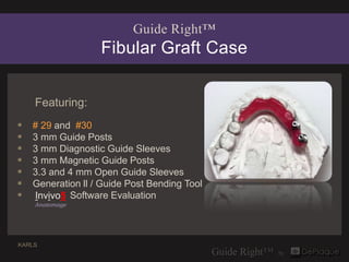 Guide Right™
                   Fibular Graft Case


    Featuring:
   # 29 and #30
   3 mm Guide Posts
   3 mm Diagnostic Guide Sleeves
   3 mm Magnetic Guide Posts
   3.3 and 4 mm Open Guide Sleeves
   Generation ll / Guide Post Bending Tool
   Invivo5 Software Evaluation
    Anatomage




KARLS
 
