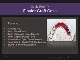 Guide Right™
                   Fibular Graft Case


    Featuring:
   # 29 and #30
   3 mm Guide Posts
   3 mm Diagnos...