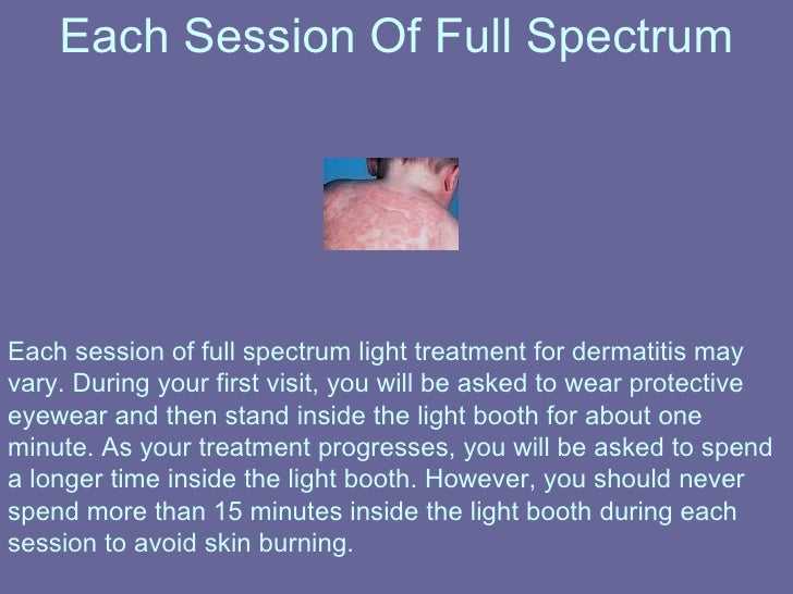 Full Spectrum Light Dermatitis Treating Your Skin Disorder