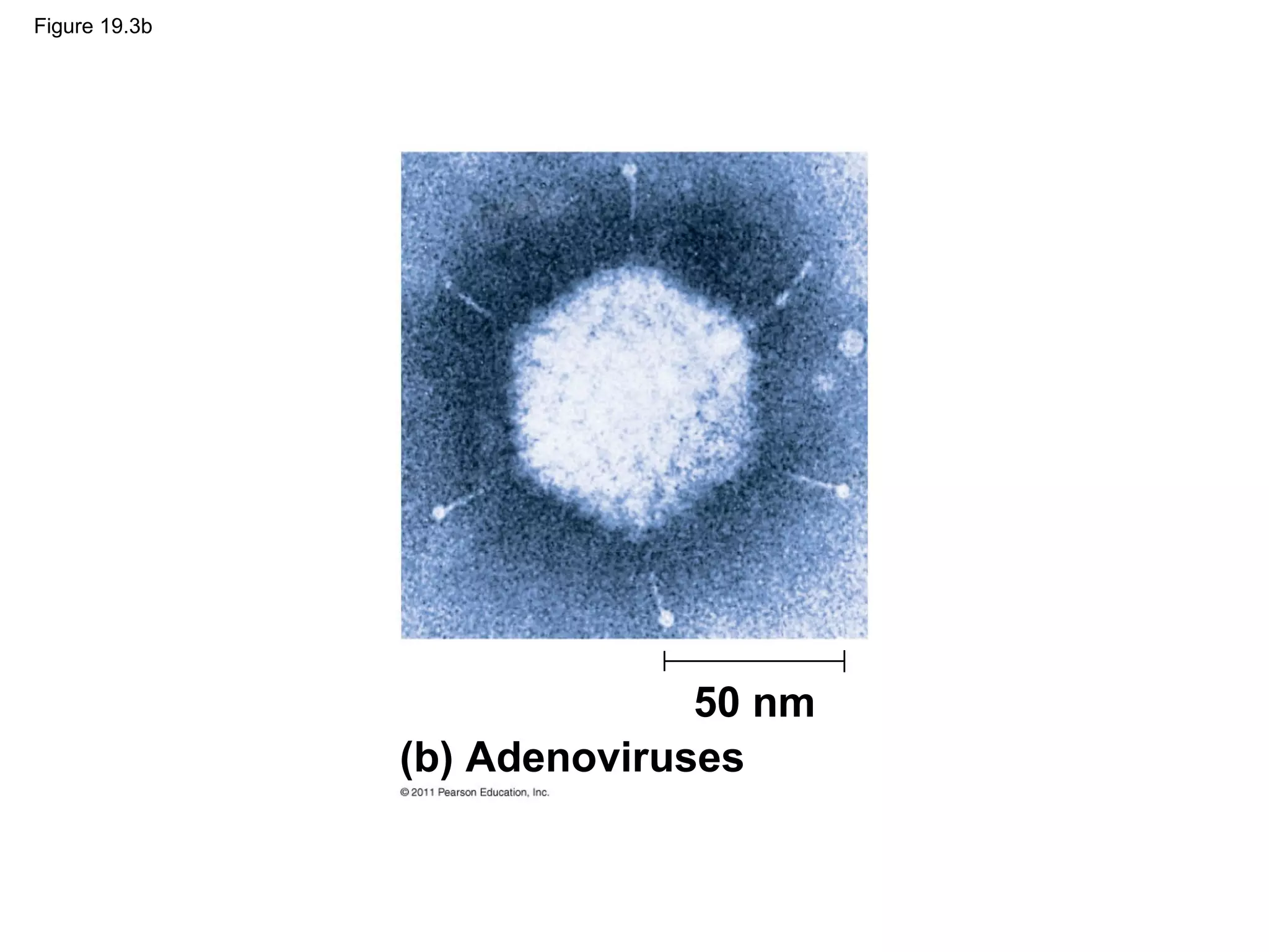 Figure 19.3b
50 nm
(b) Adenoviruses
 