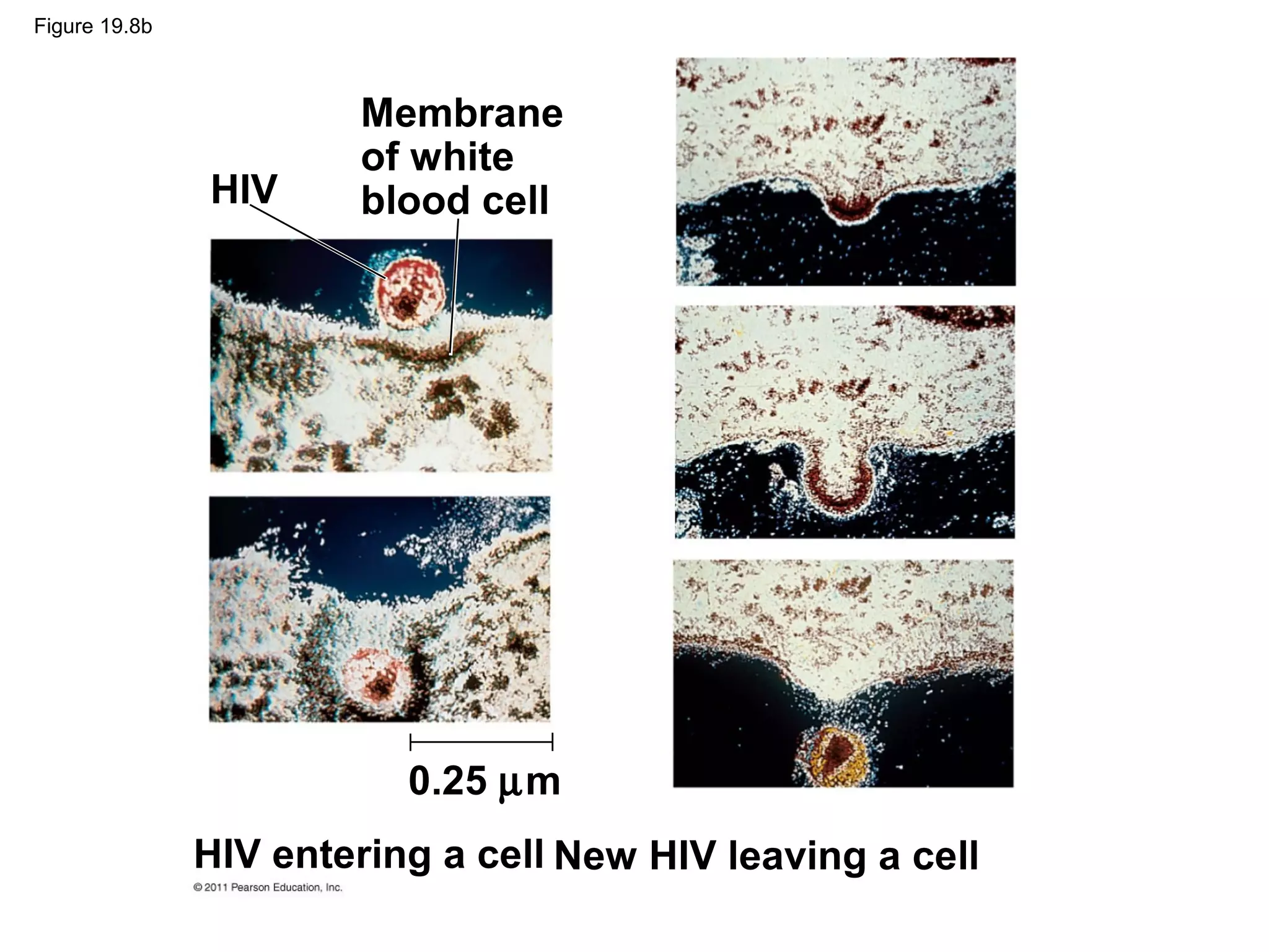 Figure 19.8b
HIV
Membrane
of white
blood cell
HIV entering a cell New HIV leaving a cell
0.25 µm
 