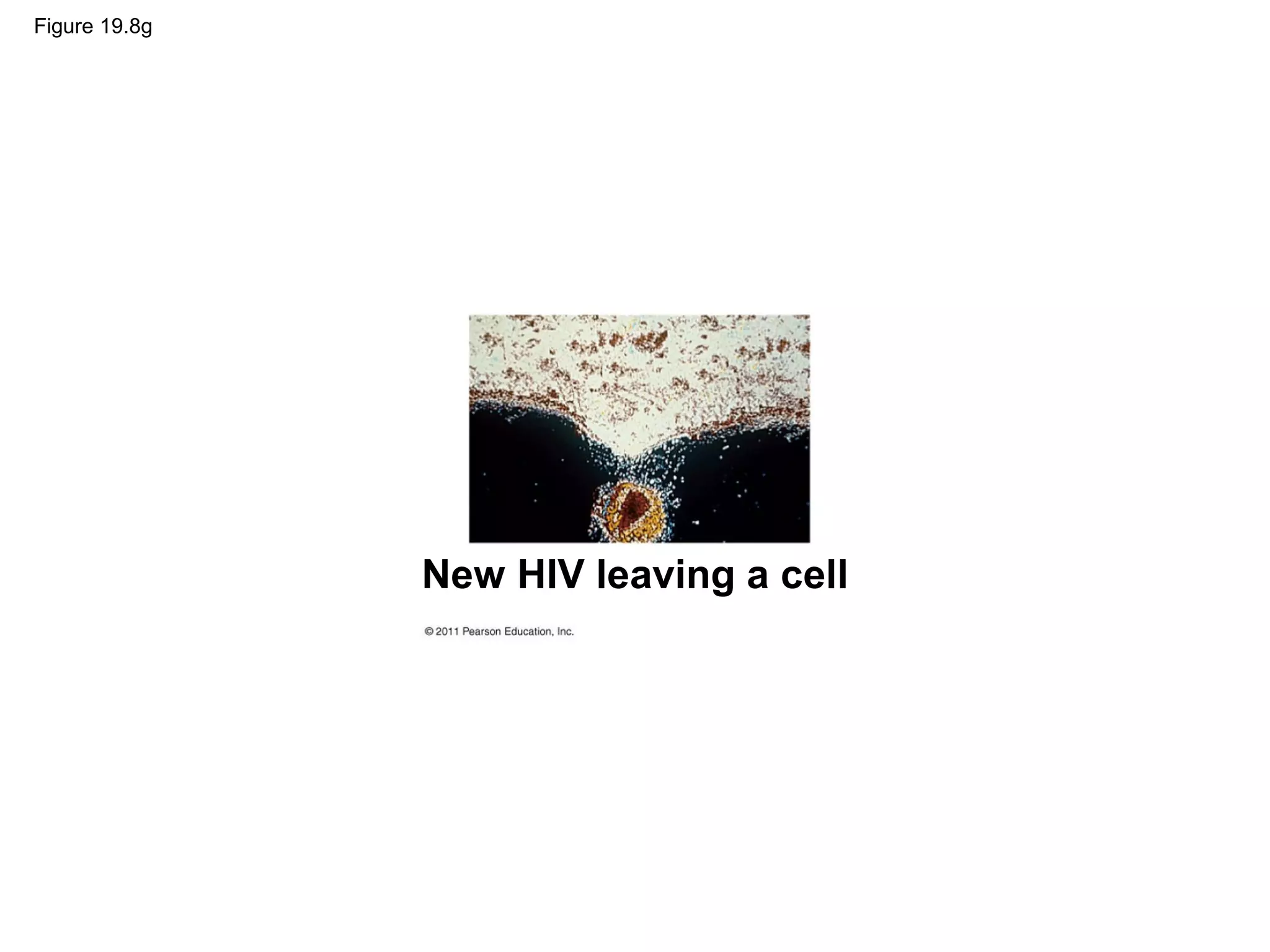 Figure 19.8g
New HIV leaving a cell
 