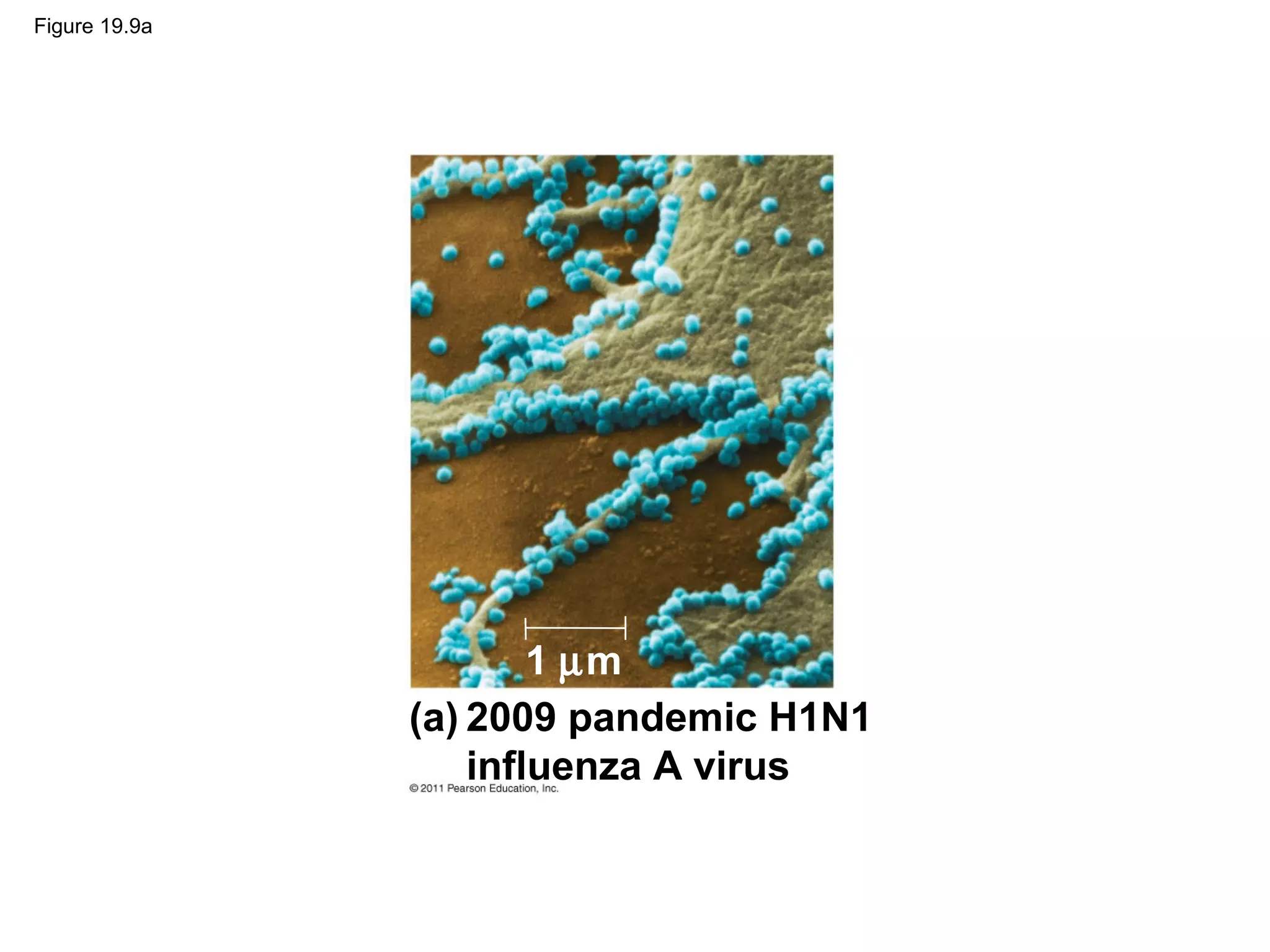 Figure 19.9a
2009 pandemic H1N1
influenza A virus
(a)
1 µm
 