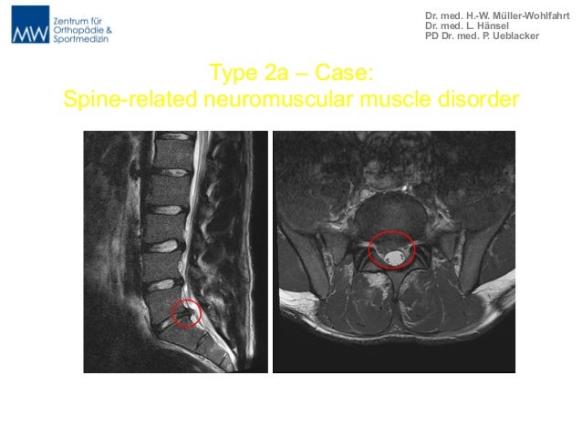 Bryan English - classification of muscle injuries in sport