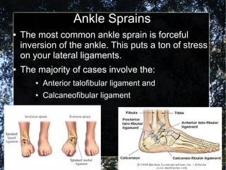 Ankle Sprains
● The most common ankle sprain is forceful
inversion of the ankle. This puts a ton of stress
on your lateral ligaments.
● The majority of cases involve the:
● Anterior talofibular ligament and
● Calcaneofibular ligament
 