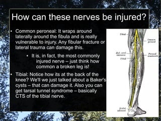 How can these nerves be injured?
● Common peroneal: It wraps around
laterally around the fibula and is really
vulnerable to injury. Any fibular fracture or
lateral trauma can damage this.
● It is, in fact, the most commonly
injured nerve – just think how
common a broken leg is!
● Tibial: Notice how its at the back of the
knee? We'll we just talked about a Baker's
cysts – that can damage it. Also you can
get tarsal tunnel syndrome – basically
CTS of the tibial nerve.
 