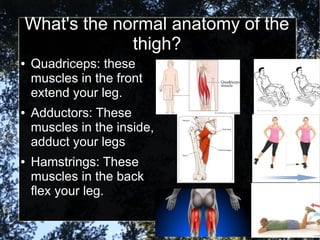 What's the normal anatomy of the
thigh?
● Quadriceps: these
muscles in the front
extend your leg.
● Adductors: These
muscles in the inside,
adduct your legs
● Hamstrings: These
muscles in the back
flex your leg.
 