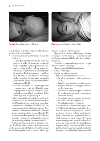 8 Y. Ballestero Díez
cará el collarín cervical (el cual puede dificultar las
maniobras de reanimación).
•	 Inmovilización cervical bimanual, existen dos
maniobras:
–	Lateral: posicionado al lateral del cuello del
paciente se coloca la mano por debajo del
cuello con pulgar e índice apoyados en occi-
pucio, resto de la palma en la parte posterior
del cuello y con antebrazo descansando sobre
la superficie donde se encuentra el acciden-
tado. Se coloca la otra mano por encima del
cuello con pulgar e índice sobre los ángulos
mandibulares, intentando llevar la mandíbula
hacia delante (Fig 2).
–	Cefálica: colocándose a la cabeza del paciente
y con una mano a cada lado del cuello. Situar
los pulgares en mandíbula elevándola y des-
plazándola hacia delante con el resto de los
dedos sujetando occipucio (Fig 3).
•	 Collarín cervical: los que realizan mejor inmovi-
lización cervical son los collarines mentonianos
tipo Philadelphia, pero requieren de inmoviliza-
ciones laterales (tipo Dama de Elche). Para ele-
gir correctamente el collarín cervical, este debe
tener una anchura similar a la distancia desde el
ángulo mandibular hasta la base del cuello. No
se recomienda el uso generalizado de collarines
cervicales en niños, si se utiliza debe ser con un
buen ajuste (posición y tamaño correctos)3.
Recolocar vía aérea: mantener la cabeza en posi-
ción de olfateo con una correcta alineación con un
ayudante, manteniendo la inmovilización cervical
durante la manipulación de la vía aérea o hasta que
se pueda colocar el collarín cervical.
Apertura de la vía aérea: debe hacerse evitándo-
se cualquier movimiento de la columna cervical,
mediante tracción mandibular o la triple maniobra
modificada.
Examinar cavidad orofaríngea: retirar cuerpos
extraños y aspirar secreciones.
Asegurar permeabilidad de la vía aérea:
•	 Cánula orofaríngea.
•	 Intubación (vía orotraqueal):
–	Indicada de forma inmediata si1,11:
-	 Parada respiratoria o cardiorrespiratoria
(PCR).
-	 Vía aérea no sostenible espontáneamente.
-	 Vía aérea obstruida o con signos inminen-
tes de obstrucción.
-	 Insuficiencia respiratoria grave (excluyen-
do previamente neumotórax a tensión o
hemotórax masivo).
-	 Shock grave que no responde a volumen.
-	 Escala de coma de Glasgow ≤ 8.
-	 Actividad convulsiva persistente.
	 Si el paciente está en situación de apnea, coma
o PCR se realizará sin premedicación. En el
resto de casos, se aconseja esperar a obtener
un acceso venoso y realizar una secuencia
rápida de intubación. Si porta collarín cer-
vical se retirará la parte anterior del mismo
mientras otra persona inmoviliza el cuello. A
menos que exista sospecha de fractura laríngea
se puede realizar maniobra de Sellick (com-
presión cricotiroidea) tanto para la intubación
como para la ventilación con bolsa-mascarilla.
Figura 2. Inmovilización cervical lateral. Figura 3. Inmovilización cervical cefálica.
 