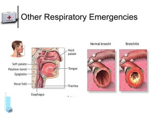 Other Respiratory Emergencies 