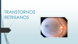 TRANSTORNOS
RETINIANOS

 