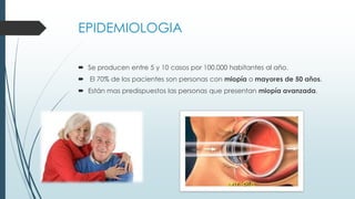 EPIDEMIOLOGIA
 Se producen entre 5 y 10 casos por 100.000 habitantes al año.
 El 70% de los pacientes son personas con miopía o mayores de 50 años.
 Están mas predispuestos las personas que presentan miopía avanzada.

 