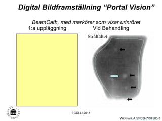 Digital Bildframställning “Portal Vision”  BeamCath, med markörer som visar urinröret 1:a uppläggning Vid Behandling Onk, NUS, A W 0504 ECCLU 2011 Strålfältet Strålfältet 