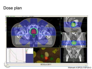 Dose plan  ECCLU 2011 
