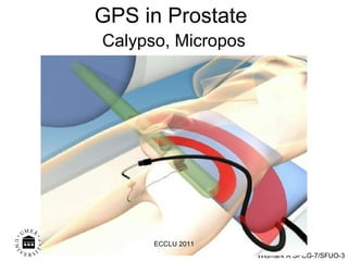 GPS in Prostate   Calypso, Micropos ECCLU 2011 