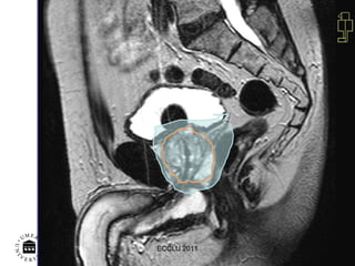 MR-Bild Onk klin, NUS, A W 9602 ECCLU 2011 