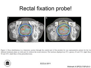 Rectal fixation probe! ECCLU 2011 