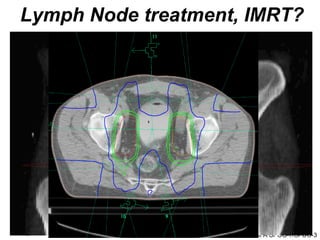 Lymph Node treatment, IMRT? ECCLU 2011 