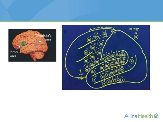 definition of eloquent cortex definition of eloquent cortex