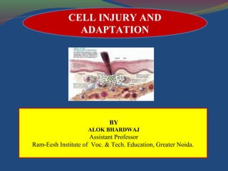 CELL INJURY AND
ADAPTATION
BY
ALOK BHARDWAJ
Assistant Professor
Ram-Eesh Institute of Voc. & Tech. Education, Greater Noida.
 