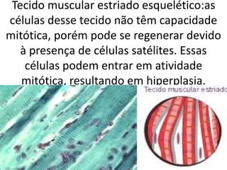 Tecido muscular estriado esquelético:as
células desse tecido não têm capacidade
mitótica, porém pode se regenerar devido
à presença de células satélites. Essas
células podem entrar em atividade
mitótica, resultando em hiperplasia.

 