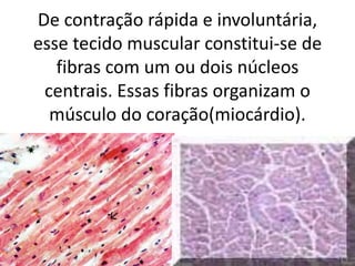 De contração rápida e involuntária,
esse tecido muscular constitui-se de
fibras com um ou dois núcleos
centrais. Essas fibras organizam o
músculo do coração(miocárdio).

 