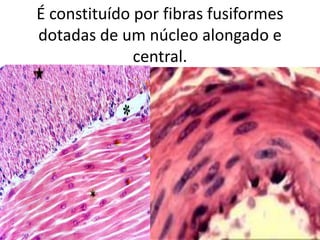 É constituído por fibras fusiformes
dotadas de um núcleo alongado e
central.

 
