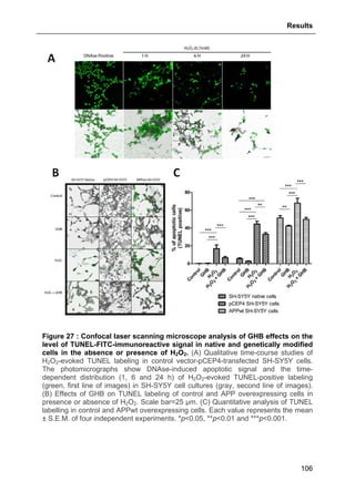 Results
106
Figure 27 : Confocal laser scanning microscope analysis of GHB effects on the
level of TUNEL-FITC-immunoreactive signal in native and genetically modified
cells in the absence or presence of H2O2. (A) Qualitative time-course studies of
H2O2-evoked TUNEL labeling in control vector-pCEP4-transfected SH-SY5Y cells.
The photomicrographs show DNAse-induced apoptotic signal and the time-
dependent distribution (1, 6 and 24 h) of H2O2-evoked TUNEL-positive labeling
(green, first line of images) in SH-SY5Y cell cultures (gray, second line of images).
(B) Effects of GHB on TUNEL labeling of control and APP overexpressing cells in
presence or absence of H2O2. Scale bar=25 μm. (C) Quantitative analysis of TUNEL
labelling in control and APPwt overexpressing cells. Each value represents the mean
± S.E.M. of four independent experiments. *p<0.05, **p<0.01 and ***p<0.001.
 
