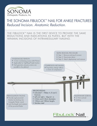 THE SONOMA FIBULOCK™
NAIL FOR ANKLE FRACTURES
Reduced Incision. Anatomic Reduction.
THE FIBULOCK™
NAIL IS THE FIRST DEVICE TO PROVIDE THE SAME
REDUCTIONS AND INDICATIONS AS PLATES, BUT WITH THE
MINIMAL INCISIONS OF INTRAMEDULLARY NAILING.
SYNDESMOSIS FIXATION
•	 3.5mm non-locking screws (40-70mm)
•	 Applicable for TightRope®
-style fixation
•	 Nail geometry ensures screws are
parallel to the plafond
TRIANGULATION TALONS
•	 Provide rigid proximal
fixation by locking into
triangular fibular canal
•	 Lock the length and rotation
of the proximal fibula
SPECIFICATIONS:
•	 Indicated for Weber A, B and C
fractures
•	 Left and right configurations
•	 3.0mm and 3.8mm diameters
•	 130mm and 180mm lengths
•	 Stainless steel
MULTI-PLANAR SCREWS
•	 2.7mm cortical
•	Locking
COMPRESSION MECHANISM
•	 Proprietary design allows
2.5mm of compression
SIMPLE REMOVAL PROCEDURE
•	 Step 1: Remove end-cap & screws
•	 Step 2: Deactivate talons
•	 Step 3: Attach slaphammer and remove
 
