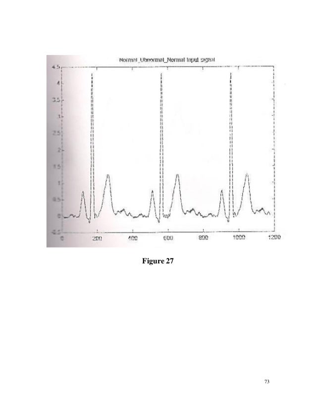 Discrete wavelet transform: a signal processing approach pdf image