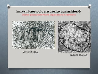 Imaxe microscopio electrónico transmisión
imaxes planas pero maior capacidade de aumentos
NÚCLEO CELULAR
MITOCONDRÍA
 