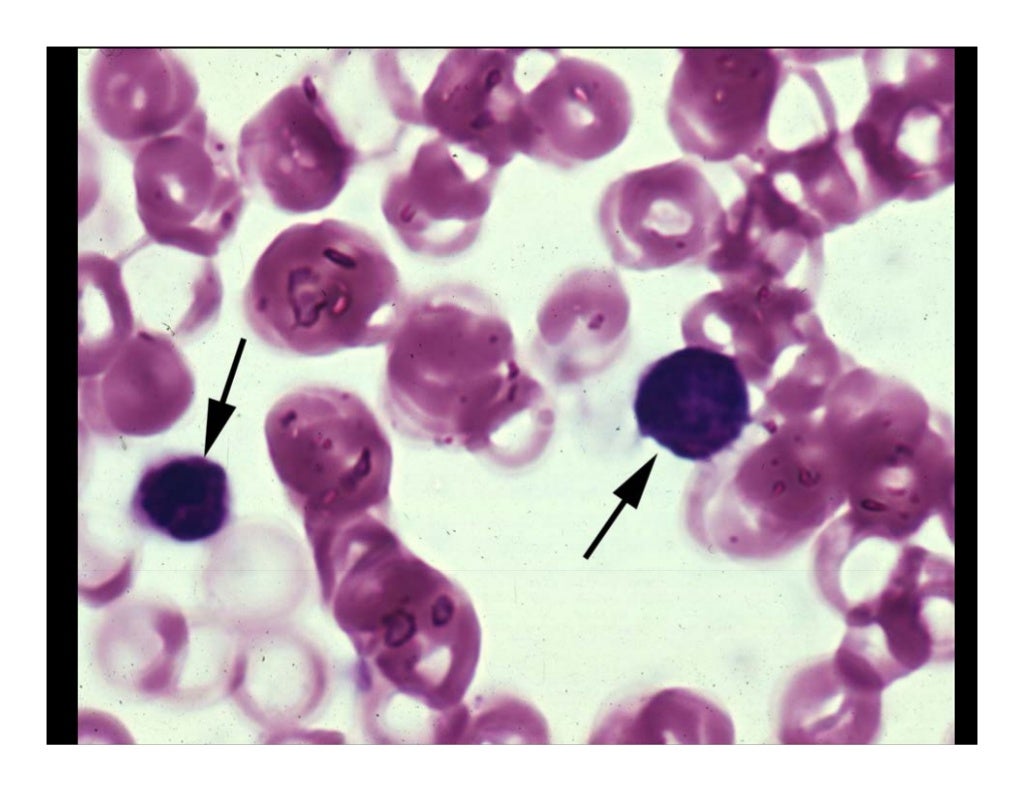 1a hematology slides