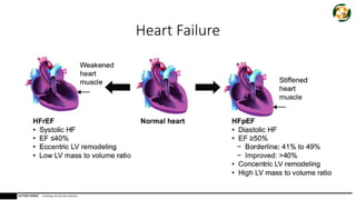 Acute heart failure diagnosis and early management | PPTX