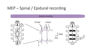 Multi model Intra operative neuromonitoring | PPTX