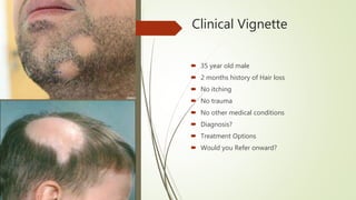 Clinical Vignette
 35 year old male
 2 months history of Hair loss
 No itching
 No trauma
 No other medical conditions
 Diagnosis?
 Treatment Options
 Would you Refer onward?
 